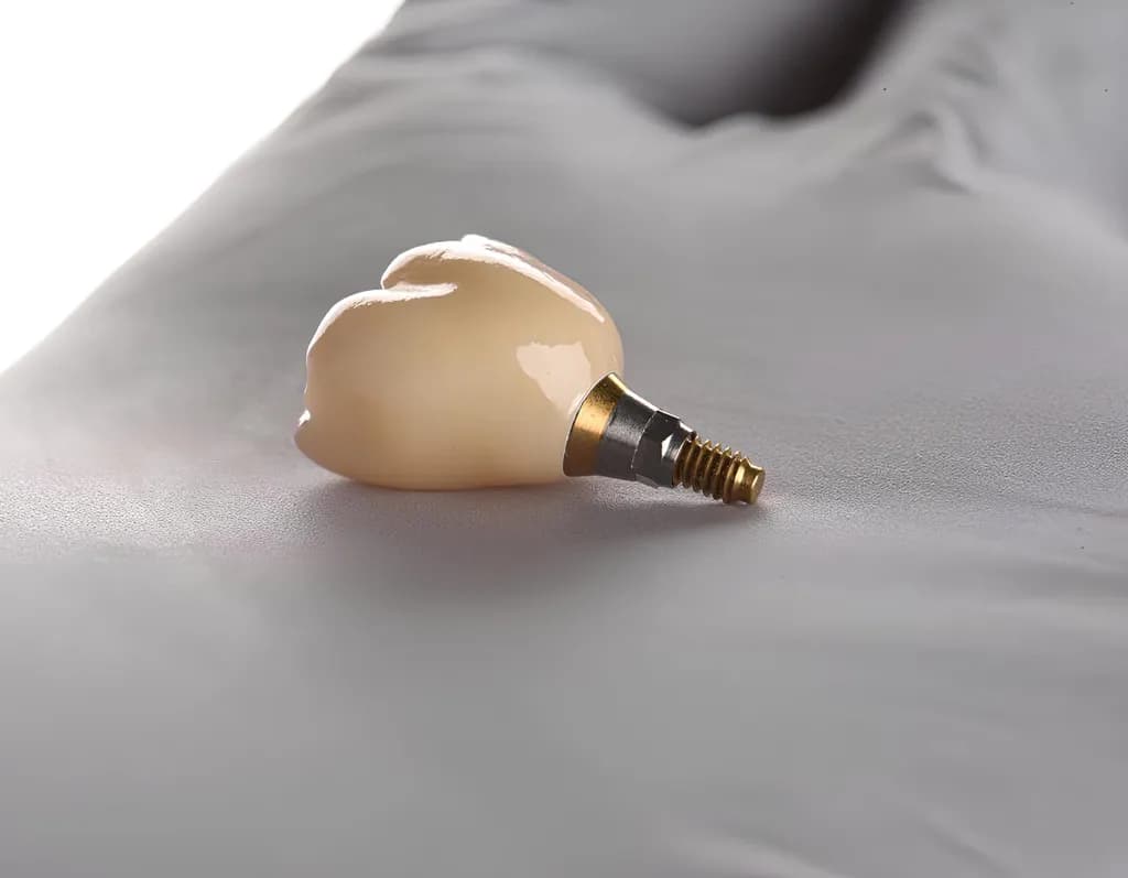 Trồng Răng Implant