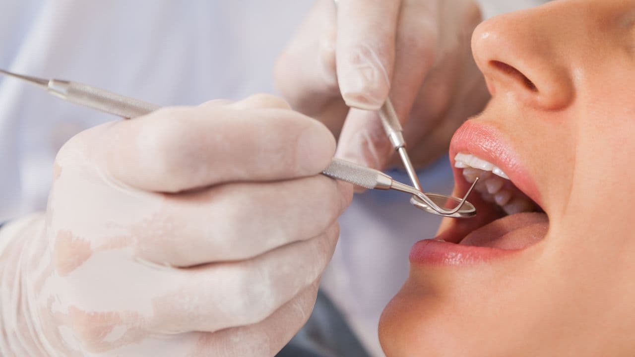 Ghép Xương Để Cấy Ghép Răng Implant: Bạn Có Thực Sự Cần Điều Này?