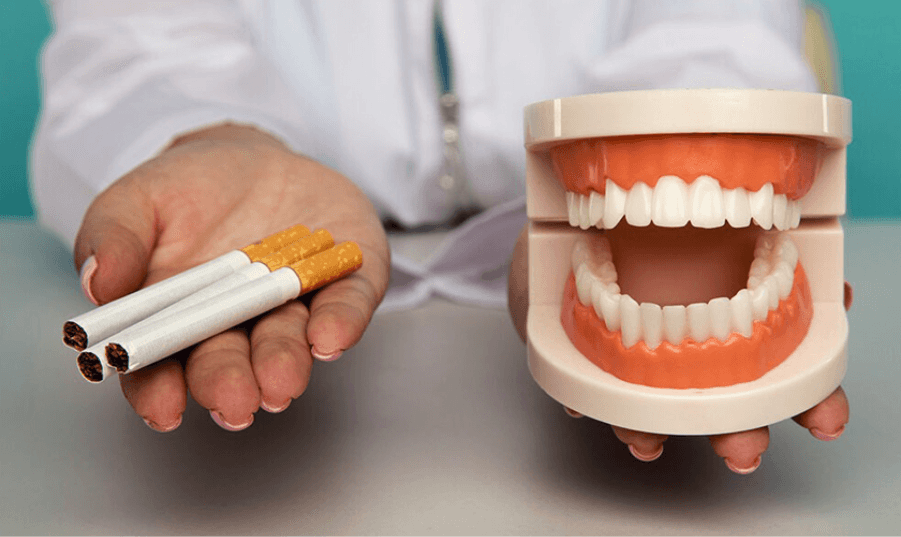 Những Người Hút Thuốc Có Thể Cấy Ghép Implant Nha Khoa Không?